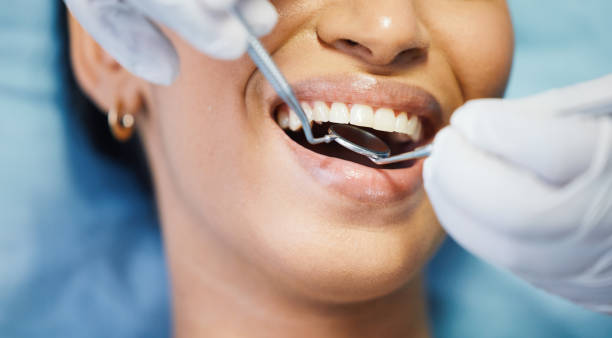 Best Emergency Dental Care for Trauma or Injury in Sparta, WI